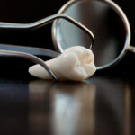 autotransplantace_-_photodune-1334291-real-human-wisdom-teeth-and-dental-instruments-s