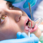 preventivni_prohlidky_-_photodune-3162936-dentist-surgery-closeup-of-womans-open-mouth-s