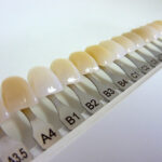 protetika_-_photodune-1460871-dental-shade-guide-s
