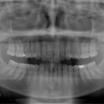 rentgenologicke_vysetreni_-_kata_z-opg