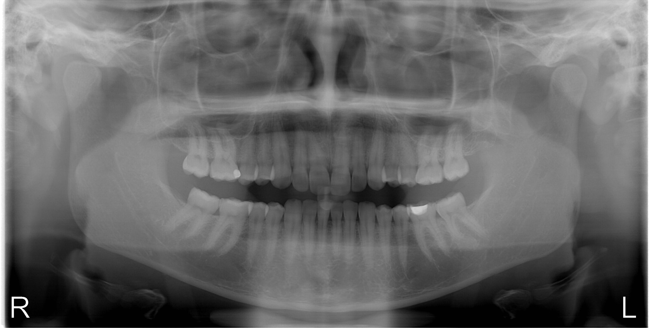 rentgenologicke_vysetreni_-_kata_z-opg